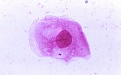 Κρούσματα μηνιγγίτιδας στην Φλόριντα