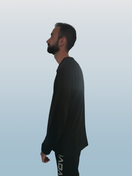 κυφωτική στάση